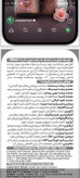 سرم ریزش مو
